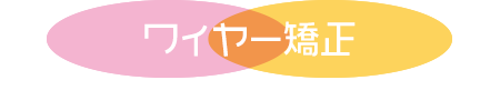 ワイヤー矯正
