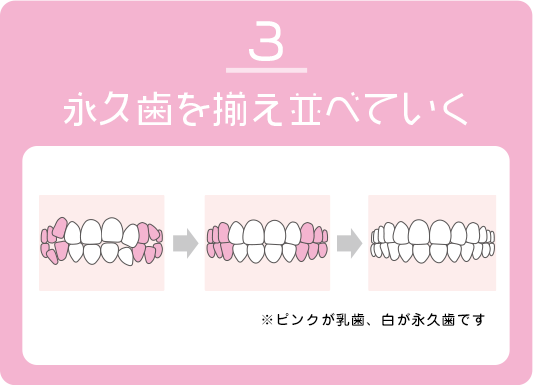 永久歯を揃え並べていく